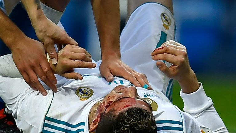 Das tat weh! Cristiano Ronaldo bekommt bei seinem Tor einen Tritt ins Gesicht.