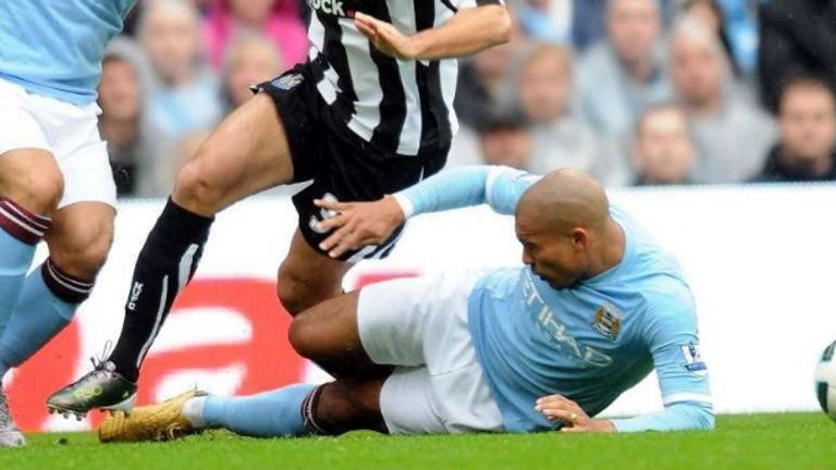 Im Jahr 2010 leistet sich de Jong gleich drei Horror-Fouls in wenigen Monaten. In der Premier League bricht er Hatem Ben Arfa mit dieser Horror-Grätsche das Bein gleich doppelt.
