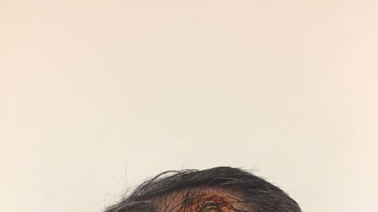 Besiktas-Trainer Senol Günes musste am Kopf getackert werden.