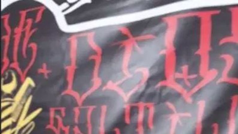 Bei diesem Fan ging die Fan-Liebe schmerzhaft unter die Haut...
(Bildquelle: Facebook @Mel Saltillo)