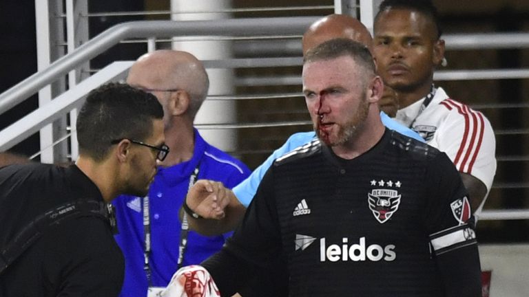 Wayne Rooney muss am Spielfeldrand mit fünf Stichen genäht werden.