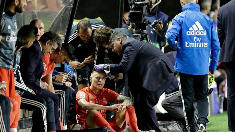 Toni Kroos wird beim Duell mit Rayo Vallecano am Kopf behandelt.