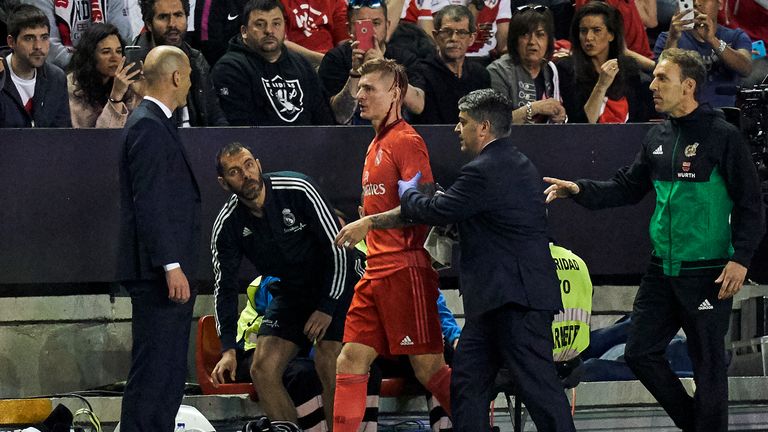 Toni Kroos wird beim Duell mit Rayo Vallecano am Kopf behandelt.