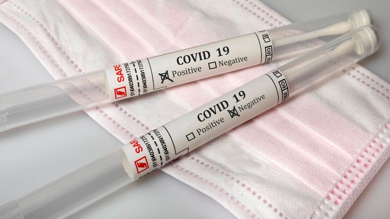 Die Bundesliga-Profis werden regelmäßig getestet.