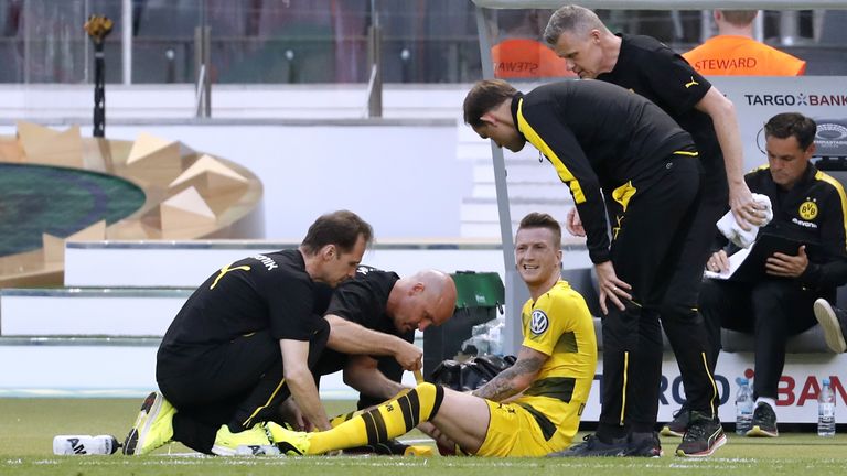 Kreuzbandriss: 29.05.2017 – 04.01.2018 - Reus verletzte sich beim Pokalfinale 2017 gegen Frankfurt in der achten Minute. Nach der OP verpasst er alle BVB-Gruppenspiele in der CL, alle Pokalspiele und steht nur in 11 Bundesligaspielen auf dem Platz.