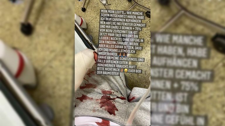 Maurice Covic hat sich beim Heimwerkern verletzt. (Fotoquelle: Instagram @maurice_covic).