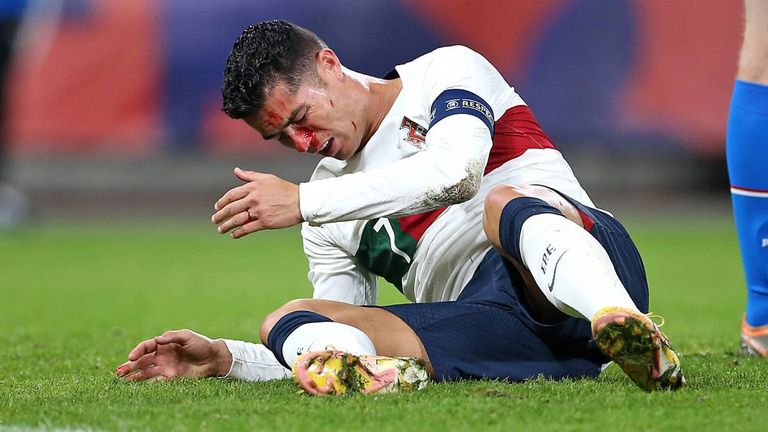 Blut im Gesicht! Cristiano Ronaldo erlebt Schock-Moment bei Portugal-Sieg gegen Tschechien
