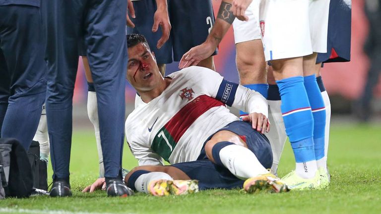 Blut im Gesicht! Cristiano Ronaldo erlebt Schock-Moment bei Portugal-Sieg gegen Tschechien