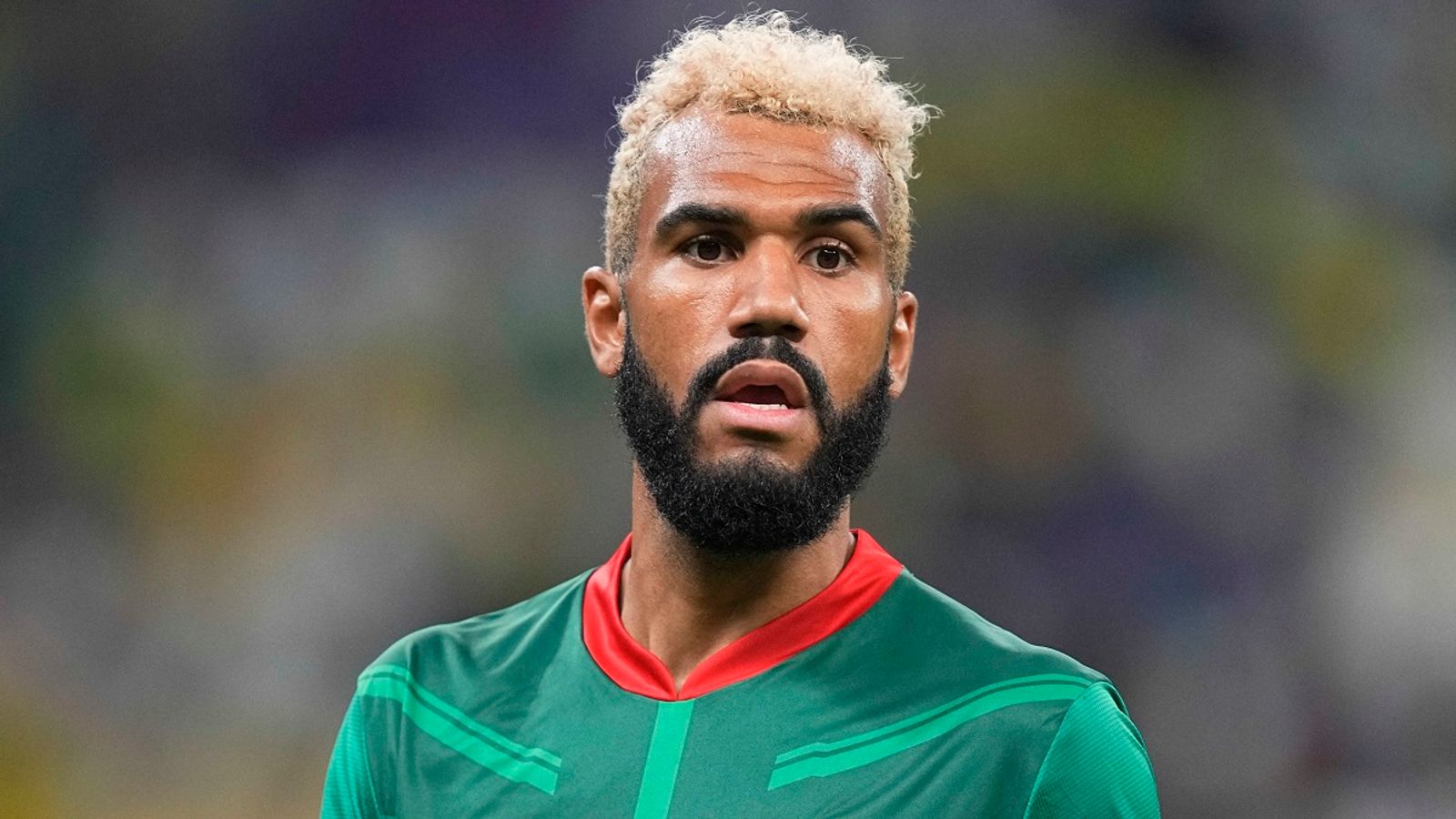 Bayerns Eric-maxim Choupo-moting Nicht Für Afrika-cup Nominiert 