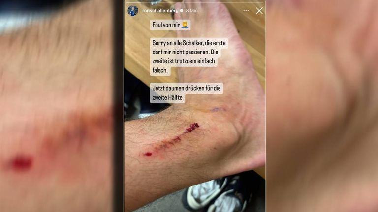 Schalkes Ron Schallenberg meldete sich nach dem Platzverweis gegen ihn via Social Media in der Halbzeit zu Wort.