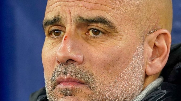 Pep Guardiola und Manchester City konnten ihre Sieglosserie auch gegen Rotterdam nicht beenden.