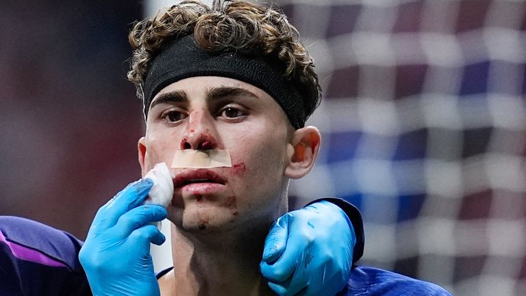 Barcas Fermin Lopez ist nach dem Aus der Champions Leage gegen Atletico sichtlich gezeichnet. 