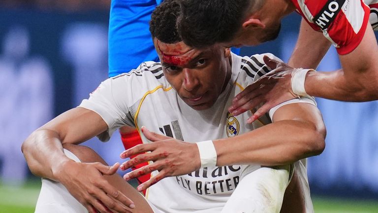 Real-Superstar Kylian Mbappe zog sich im LaLiga-Duell gegen den FC Girona eine blutige Kopfverletzung zu.