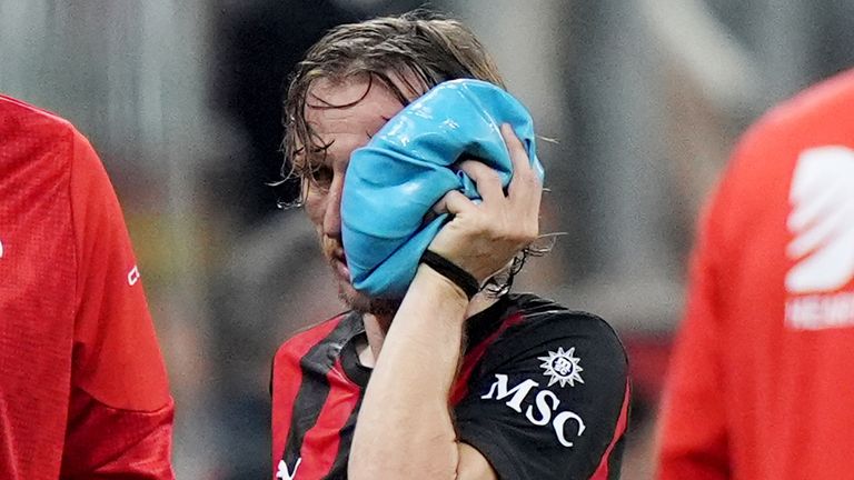 Luka Modric verletzte sich in der Partie gegen Juventus Turin im Gesicht.