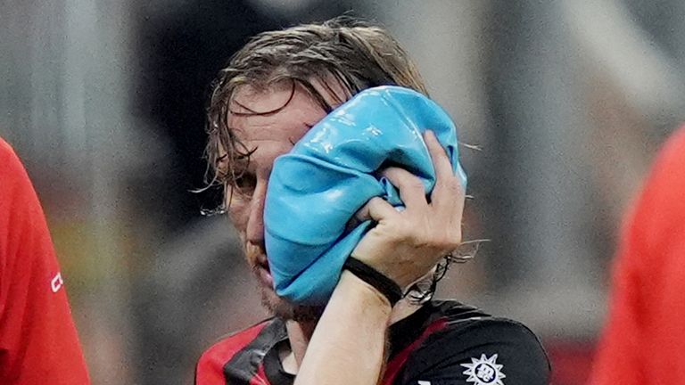 AC Milan's Luka Modric is injured during the Serie A soccer match between AC Milan and Juventus, in Milan, Italy, Sunday, April 26, 2026
