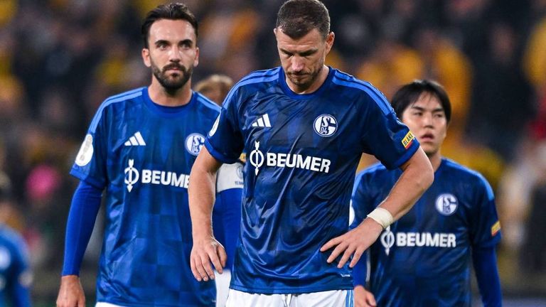 Edin Dzeko (m.) wartet in der aktuellen Saison noch auf sein erstes Tor.
