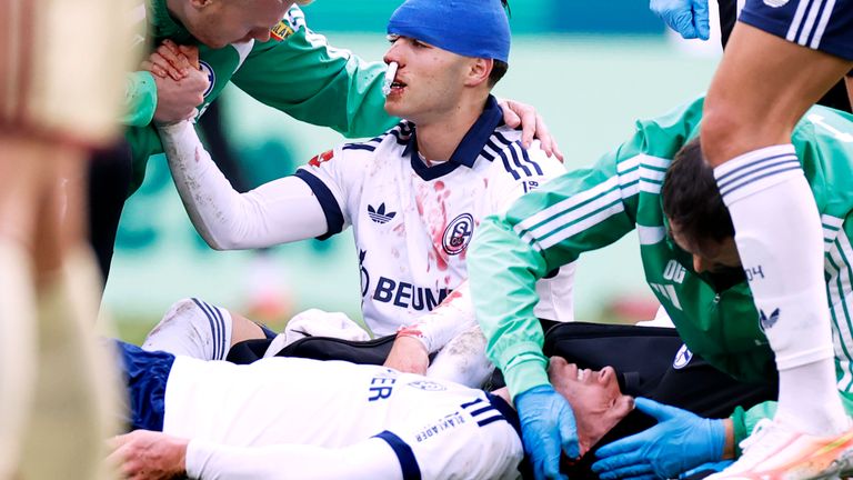 Schalkes Robin Gosens (unten) und Soufiane El-Faouzi (oben) mussten nach einem Zusammenprall ausgewechselt werden. 